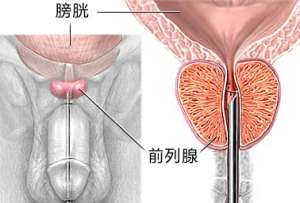 前列腺炎怎么检查呢