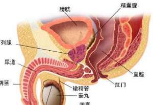 男性什么可以治前列腺炎