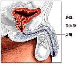 前列腺炎尿血怎么办